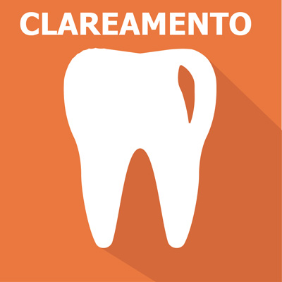 CLAREAMENTO-DENTAL-MOGI-GUAÇÚ